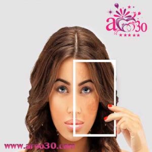 مراقبت از پوست