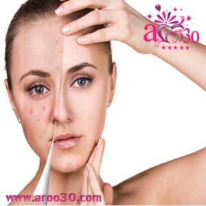 پاکسازی پوست صورت در خانه ، آرایشگاه یا پاکسازی کلینیکا