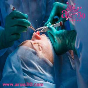 مجازات عجیب تخلفات جراحی‌های زیبایی | هشدار به آرایشگاه‌ها و بلاگرها